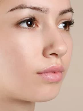 Active Acne & Breakouts treatment at Marie Jé Aesthetics