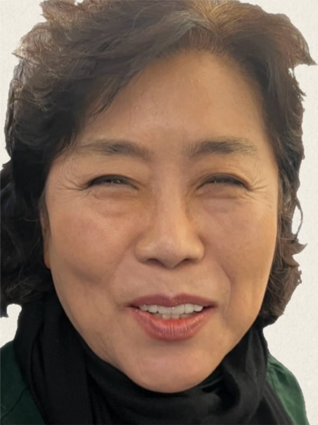 A client's lifted, rested face after XERF treatment