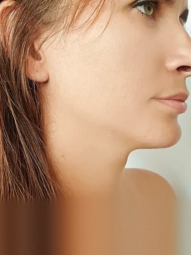 Sagging Skin & Loose Neck treatment at Marie Jé Aesthetics