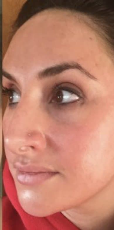 Pigmentation visibly faded, after