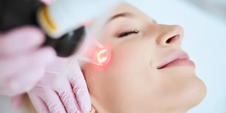 Laser facial treatment in progress