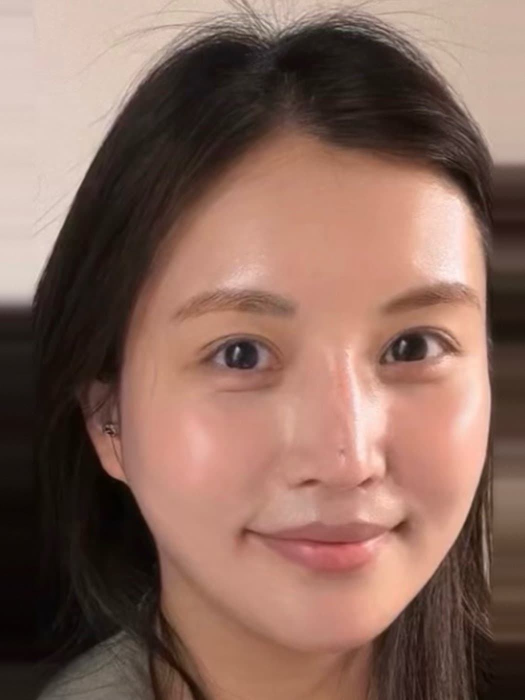 Wrinkles & Fine Lines treatment at Marie Jé Aesthetics