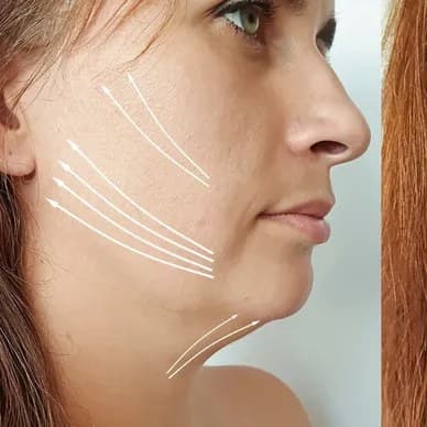 A tighter jaw and neck line, before